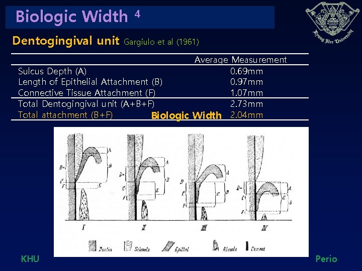 Biologic Width Dentogingival unit 4 Gargiulo et al (1961) 　 　Average Measurement Sulcus Depth
