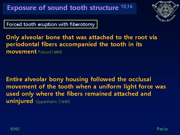 Exposure of sound tooth structure 10, 16 Forced tooth eruption with fiberotomy Only alveolar