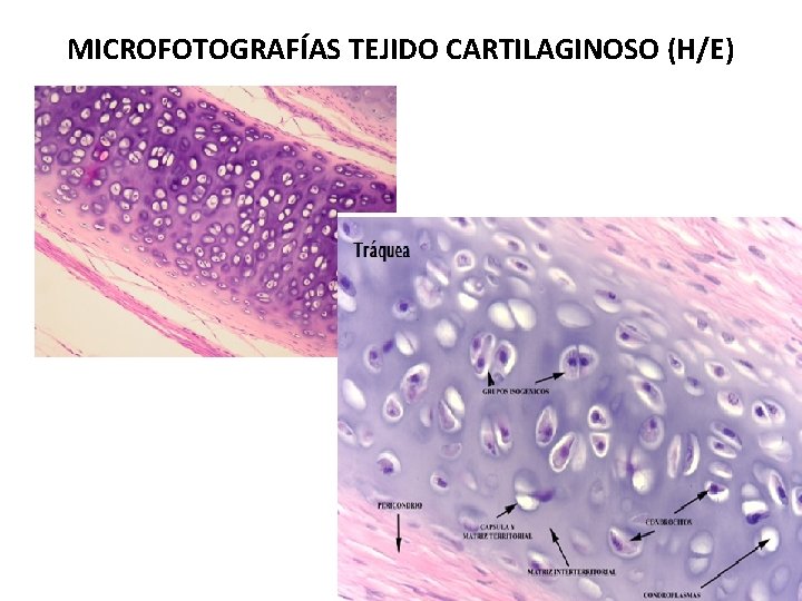 MICROFOTOGRAFÍAS TEJIDO CARTILAGINOSO (H/E) 