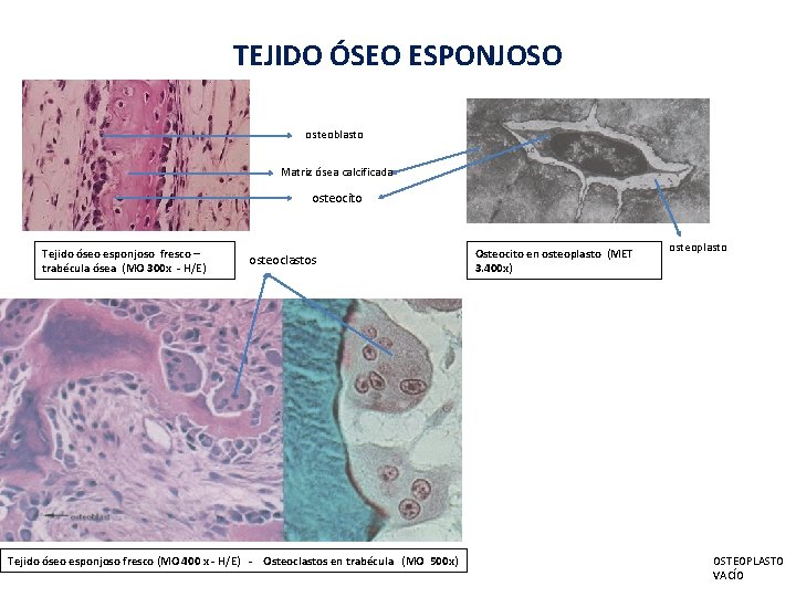 TEJIDO ÓSEO ESPONJOSO osteoblasto Matriz ósea calcificada osteocito Tejido óseo esponjoso fresco – trabécula