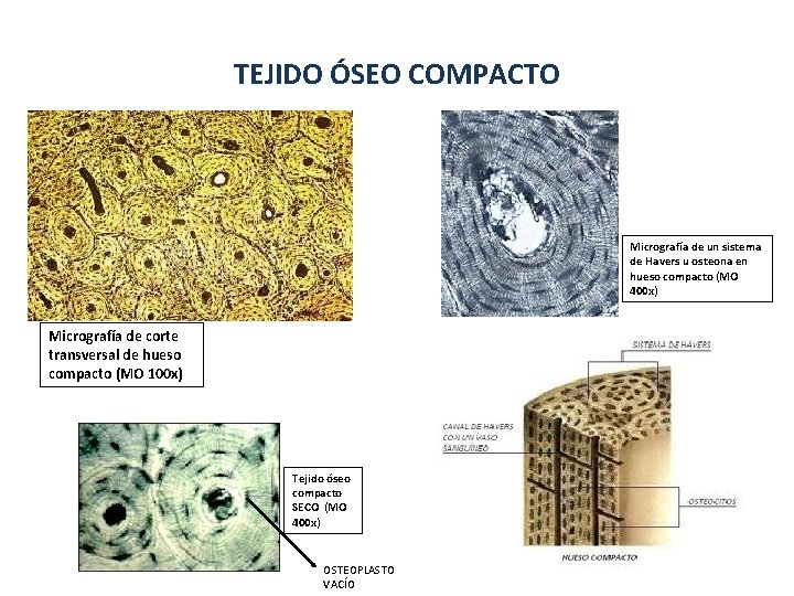 TEJIDO ÓSEO COMPACTO Micrografía de un sistema de Havers u osteona en hueso compacto