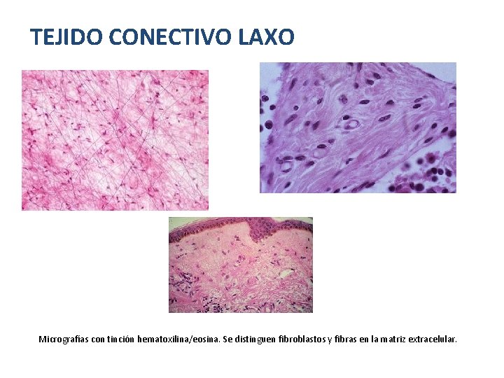 TEJIDO CONECTIVO LAXO Micrografías con tinción hematoxilina/eosina. Se distinguen fibroblastos y fibras en la