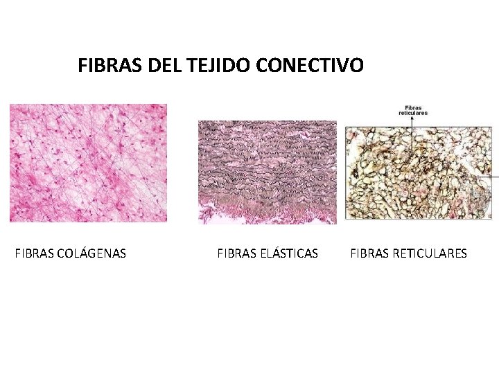 FIBRAS DEL TEJIDO CONECTIVO FIBRAS COLÁGENAS FIBRAS ELÁSTICAS FIBRAS RETICULARES 