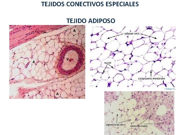 TEJIDOS CONECTIVOS ESPECIALES TEJIDO ADIPOSO 