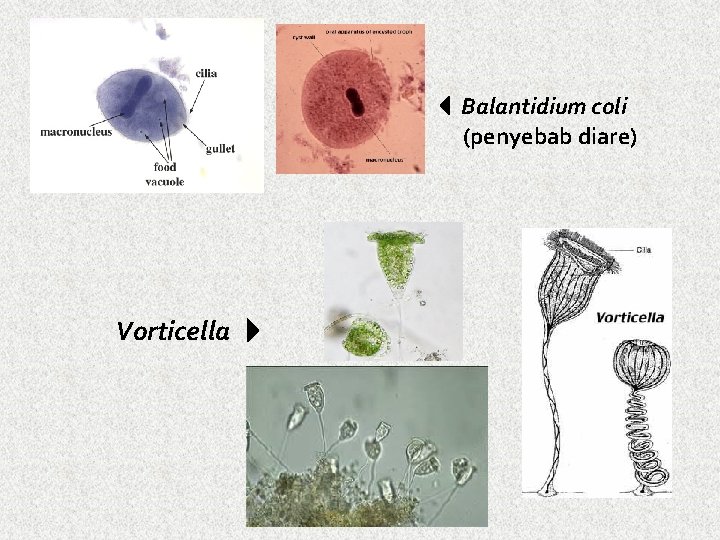  Balantidium coli (penyebab diare) Vorticella 