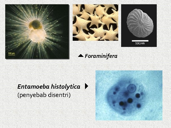  Foraminifera Entamoeba histolytica (penyebab disentri) 