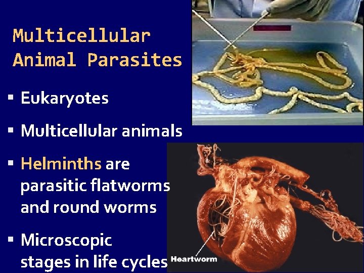 Multicellular Animal Parasites Eukaryotes Multicellular animals Helminths are parasitic flatworms and round worms Microscopic