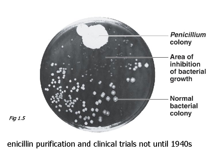 Fig 1. 5 enicillin purification and clinical trials not until 1940 s 