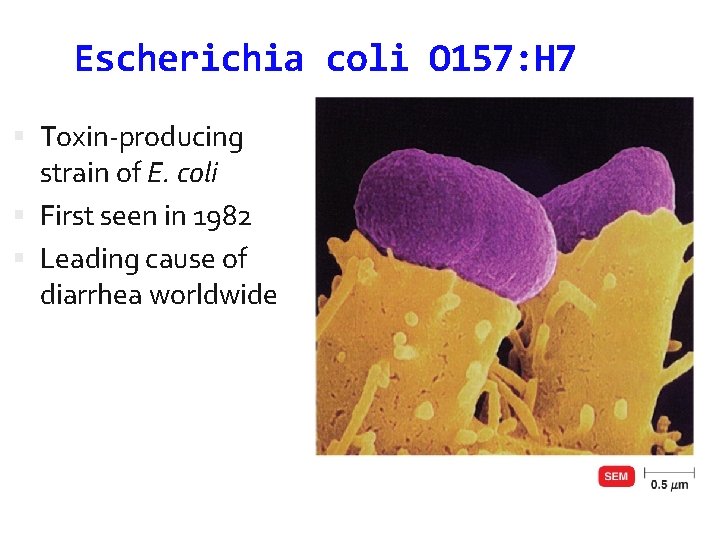 Escherichia coli O 157: H 7 Toxin-producing strain of E. coli First seen in
