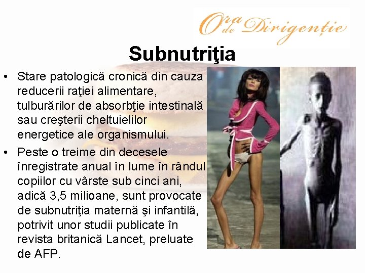 Subnutriţia • Stare patologică cronică din cauza reducerii raţiei alimentare, tulburărilor de absorbţie intestinală