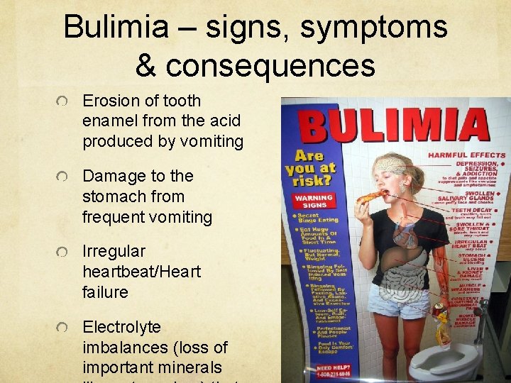 Bulimia – signs, symptoms & consequences Erosion of tooth enamel from the acid produced