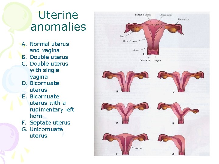 Uterine anomalies A. Normal uterus and vagina B. Double uterus C. Double uterus with