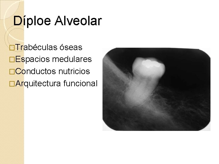 Díploe Alveolar �Trabéculas óseas �Espacios medulares �Conductos nutricios �Arquitectura funcional 
