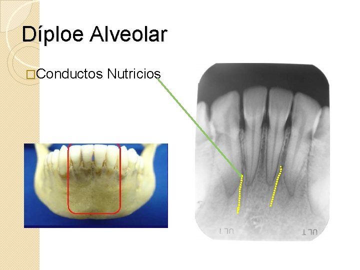 Díploe Alveolar �Conductos Nutricios 