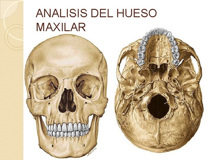 ANALISIS DEL HUESO MAXILAR 