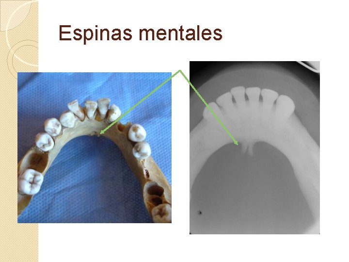 Espinas mentales 