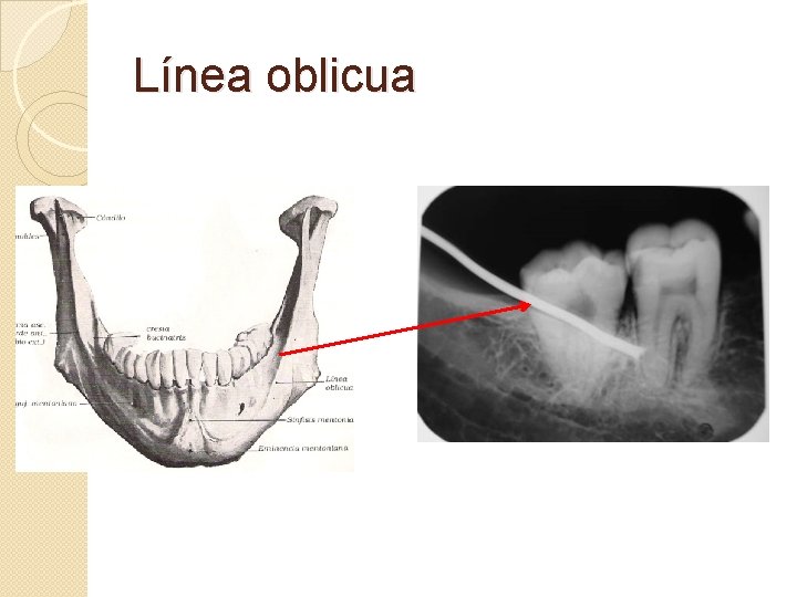 Línea oblicua 