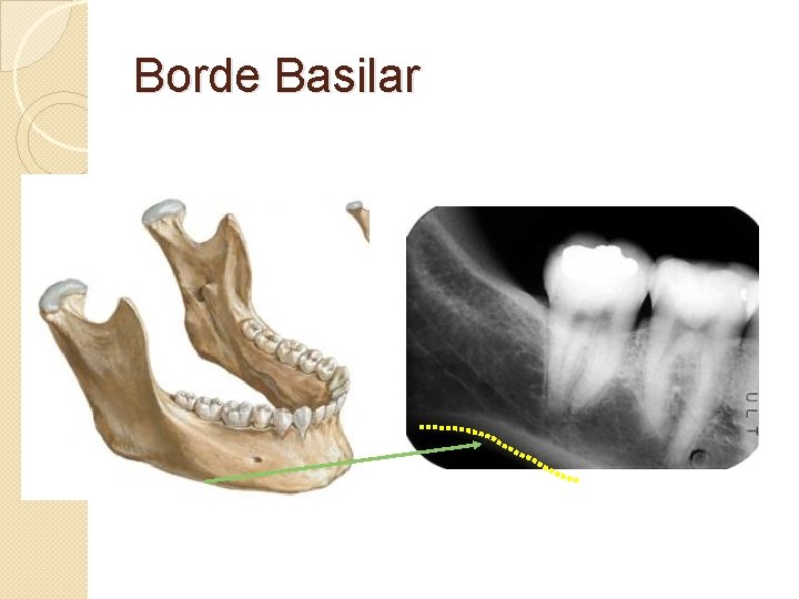 Borde Basilar 