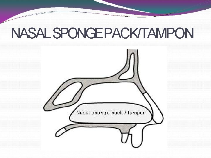 NASAL SPONGEPACK/TAMPON 