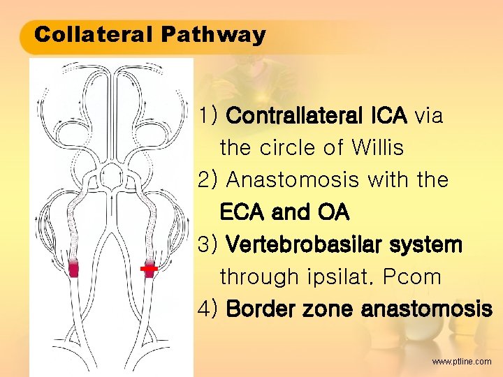 Collateral Pathway 1) Contrallateral ICA via the circle of Willis 2) Anastomosis with the