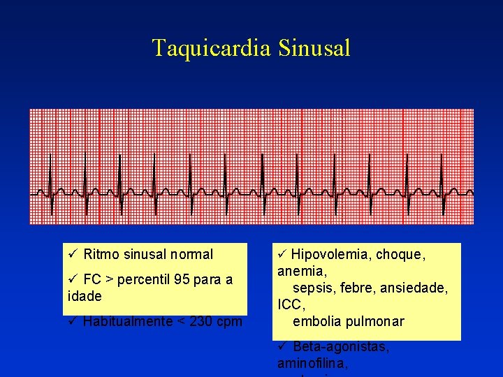 Taquicardia Sinusal ü Ritmo sinusal normal ü FC > percentil 95 para a idade