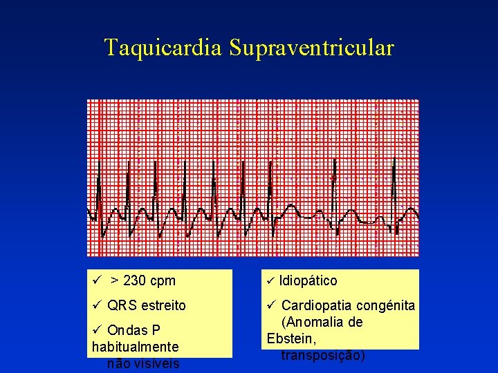 Taquicardia Supraventricular ü > 230 cpm ü Idiopático ü QRS estreito ü Cardiopatia congénita Taquicardia Supraventricular ü > 230 cpm ü Idiopático ü QRS estreito ü Cardiopatia congénita