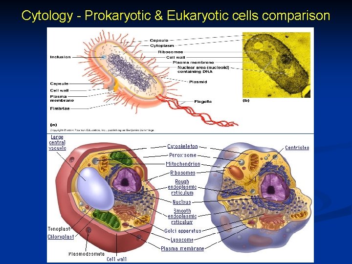 Cytology - Prokaryotic & Eukaryotic cells comparison 