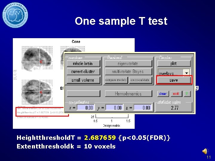 One sample T test spm. T_0001. img Heightthreshold. T = 2. 687659 {p<0. 05(FDR)}