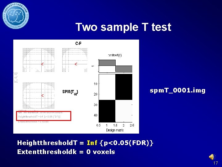 Two sample T test spm. T_0001. img Heightthreshold. T = Inf {p<0. 05(FDR)} Extentthresholdk