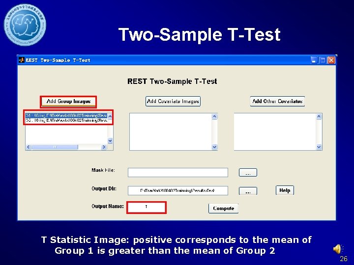 Two-Sample T-Test T Statistic Image: positive corresponds to the mean of Group 1 is