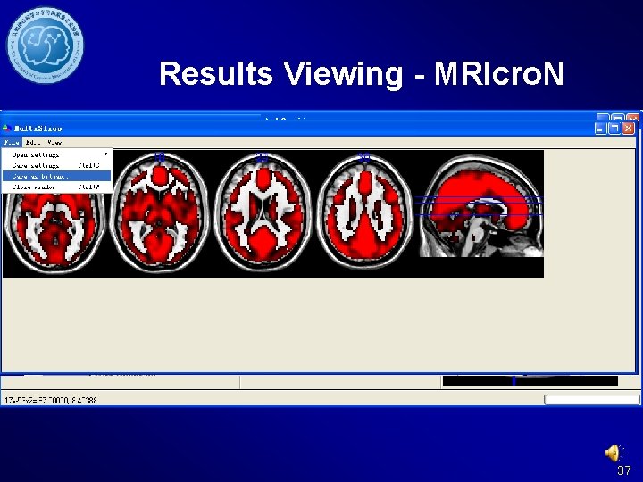 Results Viewing - MRIcro. N 37 