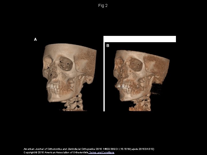 Fig 2 American Journal of Orthodontics and Dentofacial Orthopedics 2015 14822 -36 DOI: (10.