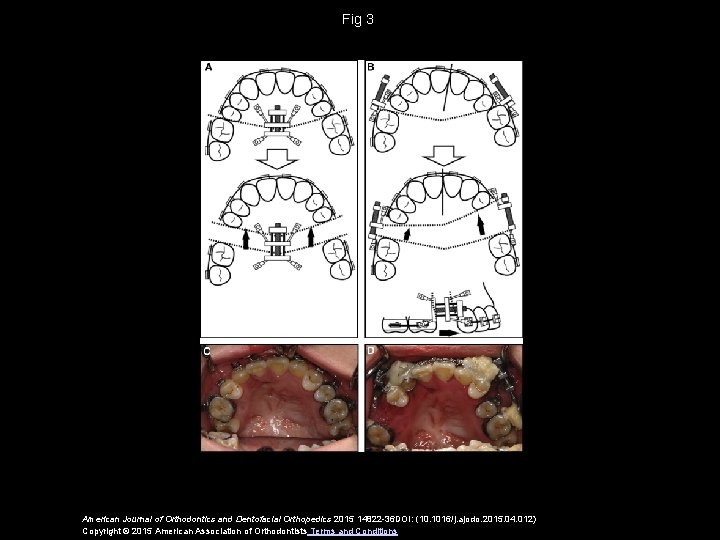 Fig 3 American Journal of Orthodontics and Dentofacial Orthopedics 2015 14822 -36 DOI: (10.