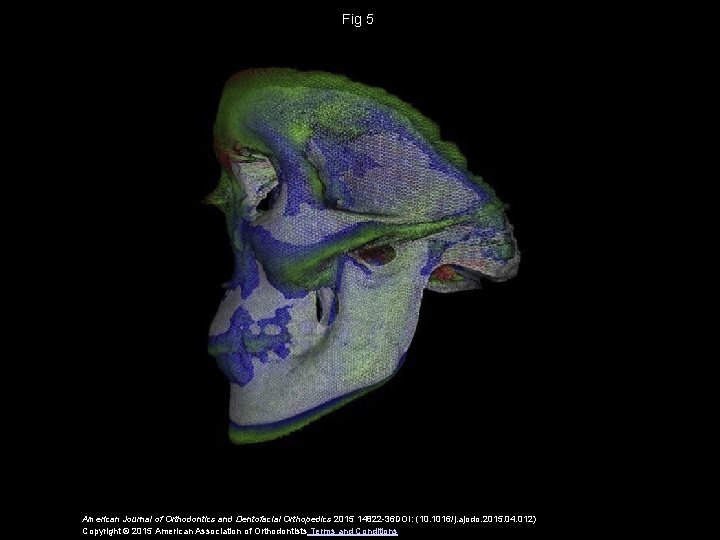 Fig 5 American Journal of Orthodontics and Dentofacial Orthopedics 2015 14822 -36 DOI: (10.