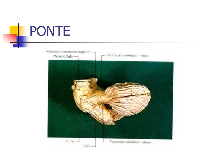 PONTE 