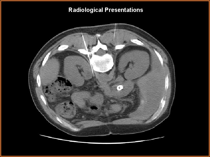 Radiological Presentations 