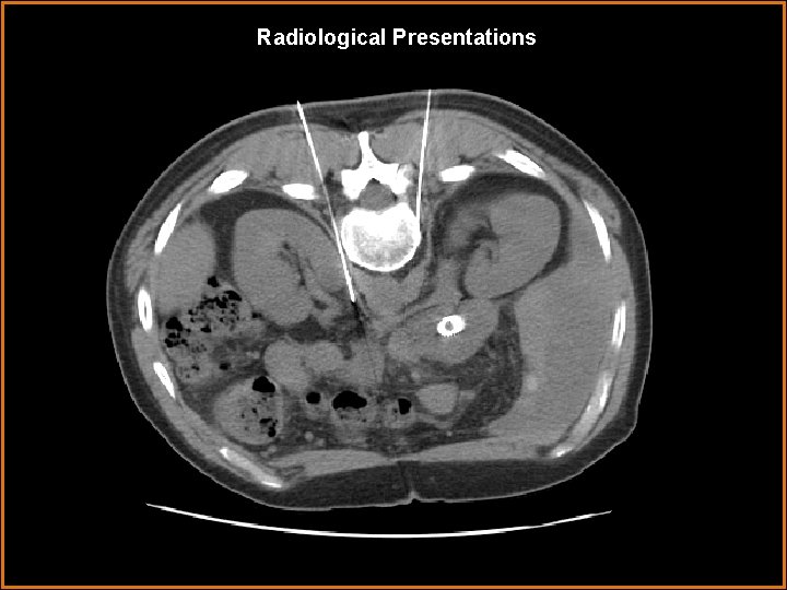 Radiological Presentations 