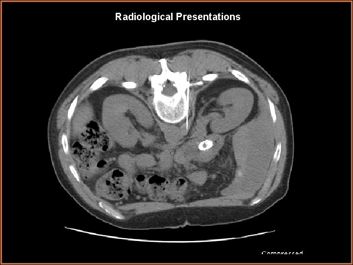 Radiological Presentations 