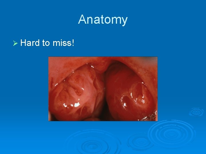 Anatomy Ø Hard to miss! 