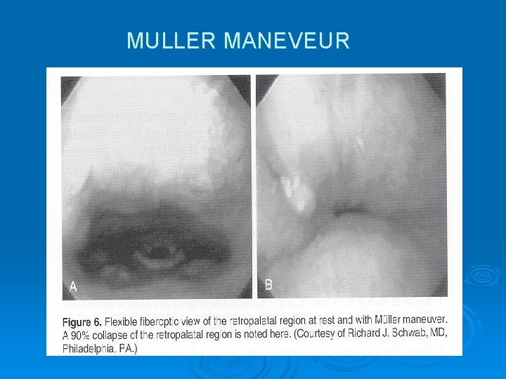 MULLER MANEVEUR 
