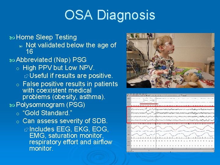 OSA Diagnosis Home Sleep Testing Not validated below the age of 16 Abbreviated (Nap)
