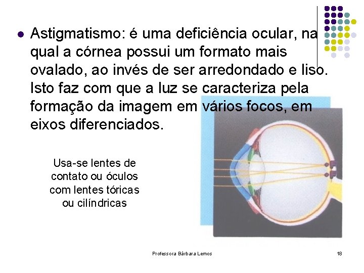 l Astigmatismo: é uma deficiência ocular, na qual a córnea possui um formato mais