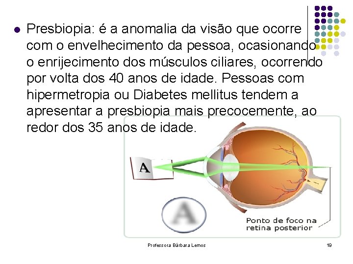 l Presbiopia: é a anomalia da visão que ocorre com o envelhecimento da pessoa,
