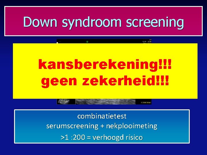 Down syndroom screening kansberekening!!! geen zekerheid!!! combinatietest serumscreening + nekplooimeting >1 : 200 =