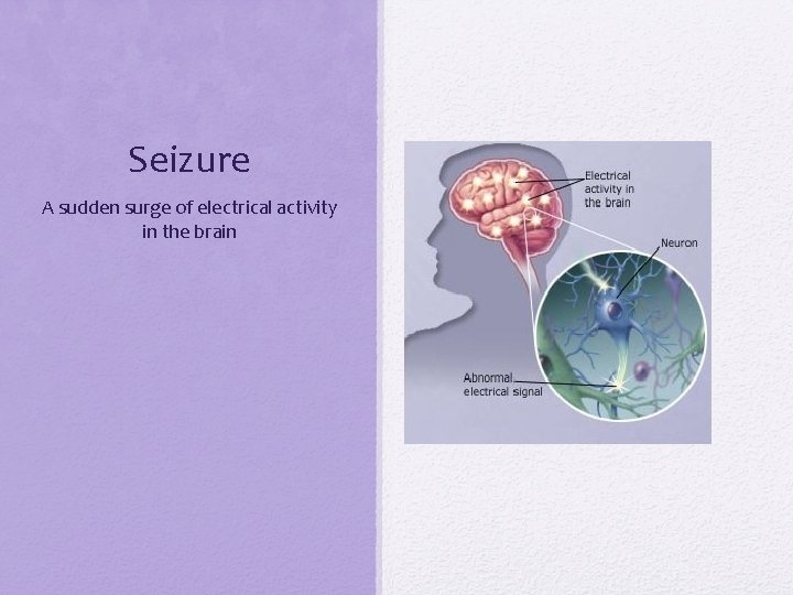 Seizure A sudden surge of electrical activity in the brain 