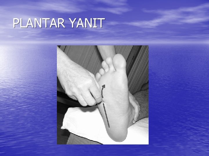 PLANTAR YANIT 