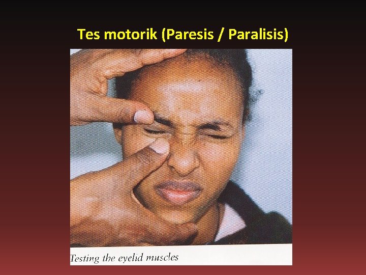 Tes motorik (Paresis / Paralisis) 