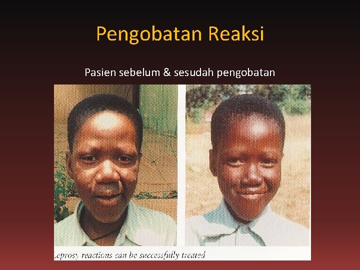 Pengobatan Reaksi Pasien sebelum & sesudah pengobatan 