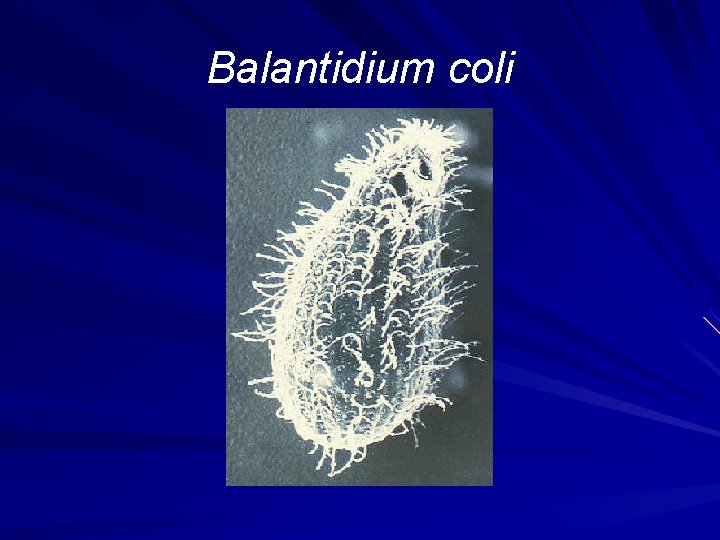 Balantidium coli 