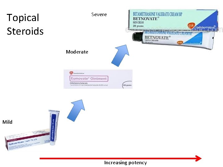 Topical Steroids Severe Moderate Mild Increasing potency Topical Steroids Severe Moderate Mild Increasing potency